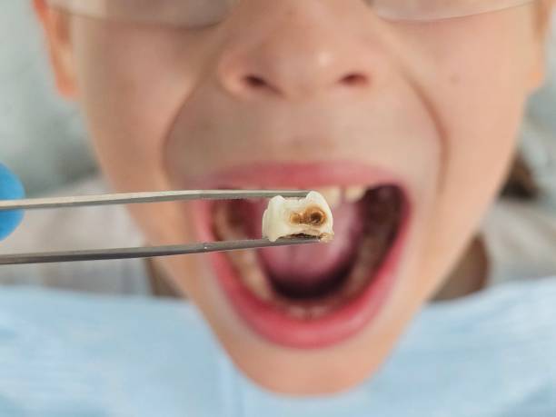 Best Knocked-Out Tooth Emergency  in Phoenix, NY